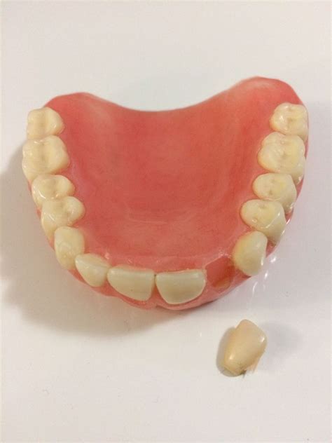 Affordable Dentures Reviews 